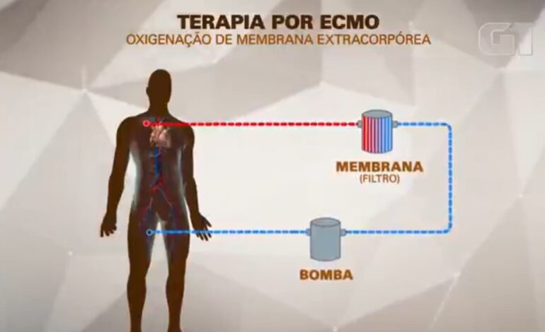 mc-marcinho-usa-terapia-conhecida-como-ecmo,-especie-de-pulmao-artificial;-entenda-como-funciona