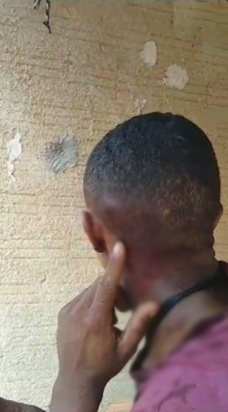 Homem leva tiro na nuca, fica com bala cravada na cabeça e luta para tomar arma de agressor