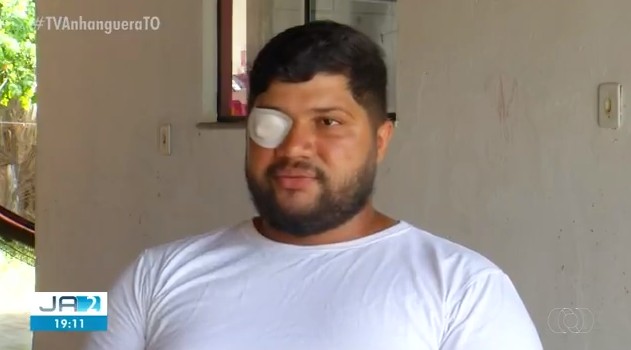entregador-agredido-com-soco-diz-que-ficou-dias-sem-enxergar,-mas-voltou-ao-trabalho: