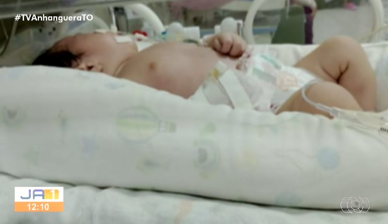 bebe-precisa-de-cirurgia-urgente-e-mae-diz-que-esta-esperando-ha-mais-de-20-dias: