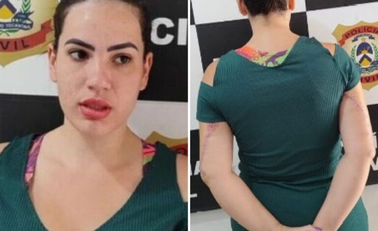 entenda-como-jovem-deu-golpes-de-r$-200-mil-em-clinicas-e-cirurgioes-plasticos-em-varios-estados: