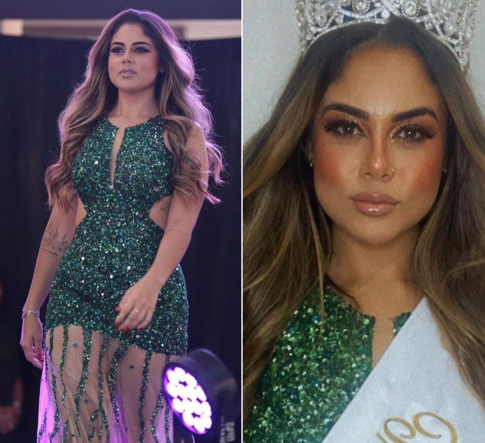 Após perder mais de 40 quilos, jovem vence concurso de beleza para pacientes bariátricas: