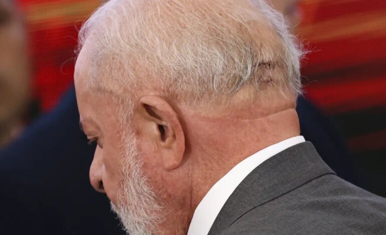 Lula fará novo procedimento médico nesta quinta
