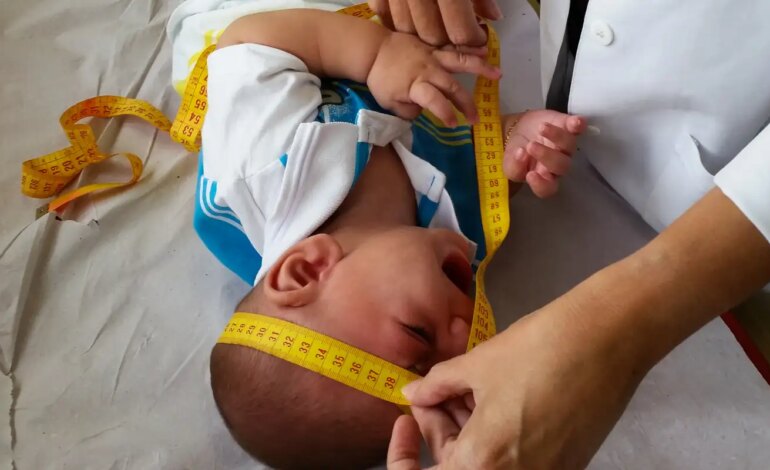 Congresso derruba veto e retoma pensão vitalícia para vítimas da zika