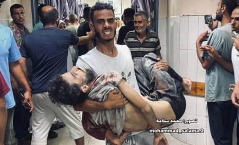 Gaza tem mais 5 mortes por fome em 24 horas, aponta Palestina