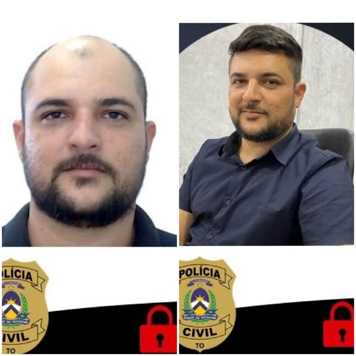 PC: foragido por fraude de R$ 55 mi no agro fez procedimento estético | G1
