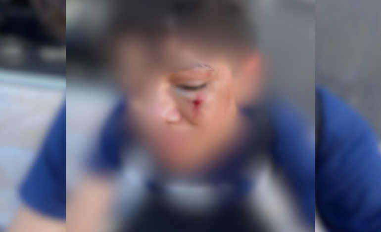 familia-denuncia-agressao-a-aluno-em-escola-apos-sofrer-bullying-|-g1
