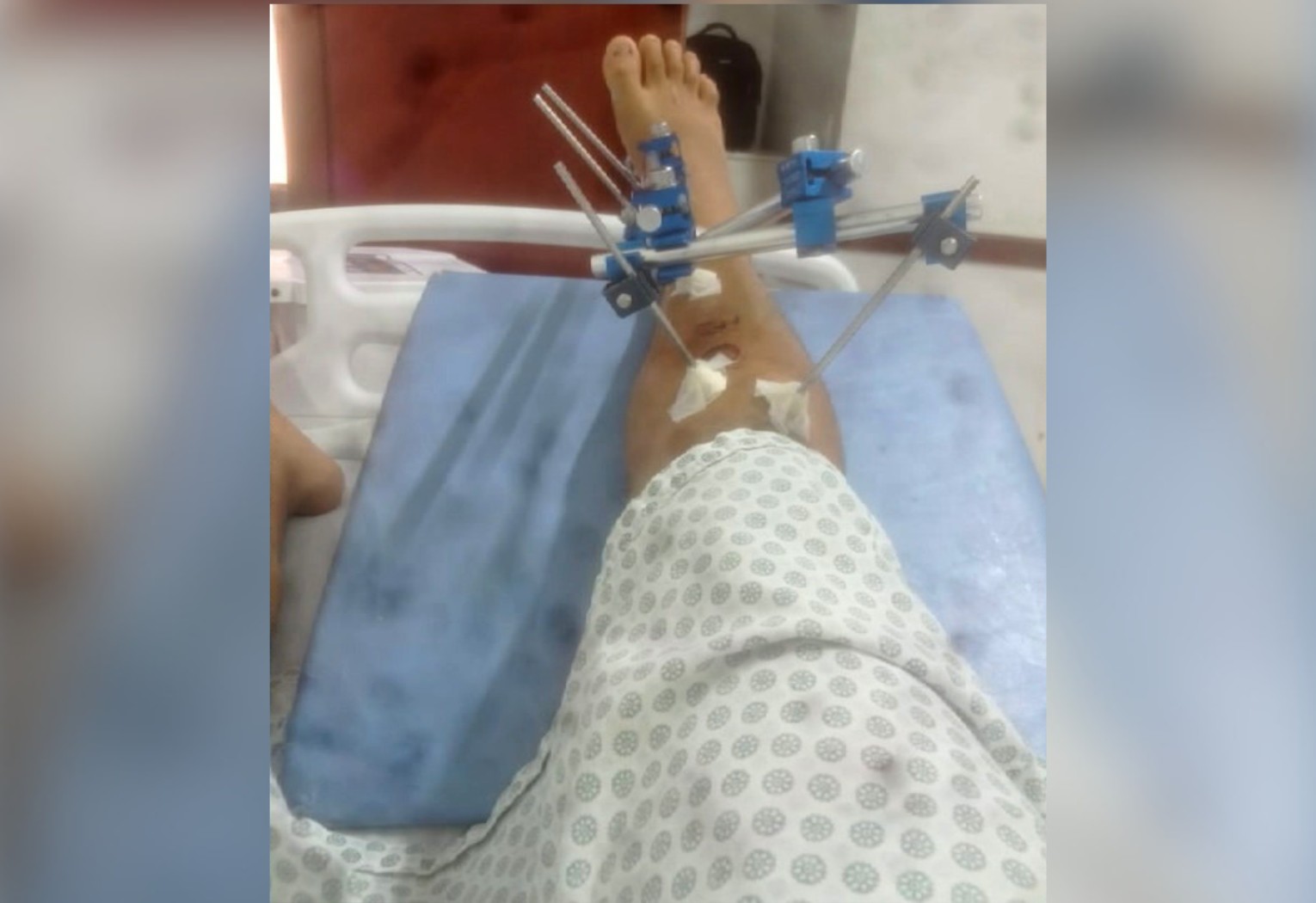 jovem-denuncia-agressao-de-pms-dentro-de-hospital-no-to-|-g1