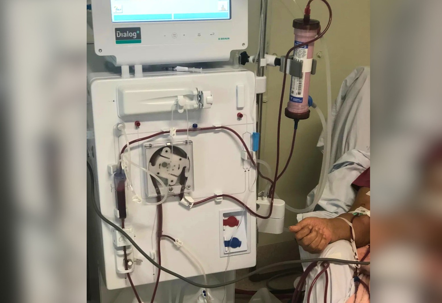 fila-de-transplante:-pacientes-do-to-perdem-consultas-por-falta-de-voos-|-g1
